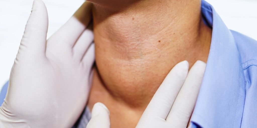 Sinais e sintomas de hipertireoidismo